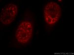 SR140 Antibody in Immunocytochemistry (ICC/IF)