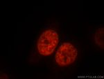 SR140 Antibody in Immunocytochemistry (ICC/IF)