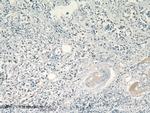 SR140 Antibody in Immunohistochemistry (Paraffin) (IHC (P))