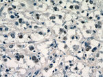 SR140 Antibody in Immunohistochemistry (Paraffin) (IHC (P))
