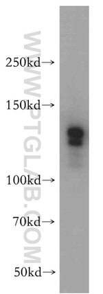 SR140 Antibody in Western Blot (WB)