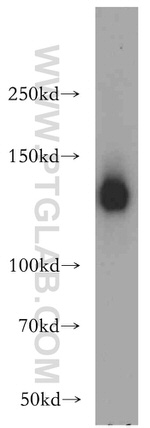 SR140 Antibody in Western Blot (WB)