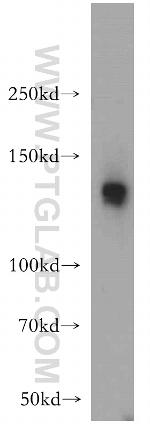 SR140 Antibody in Western Blot (WB)