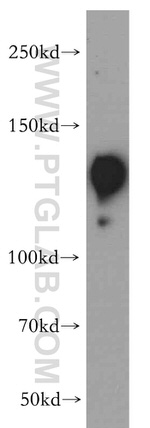SR140 Antibody in Western Blot (WB)