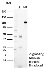 ALCAM (Activated Leukocyte Cell Adhesion Molecule)/CD166 Antibody in SDS-PAGE (SDS-PAGE)