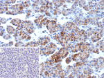 ALCAM (Activated Leukocyte Cell Adhesion Molecule)/CD166 Recombinant Mouse Monoclonal Antibody (rMOG/07)