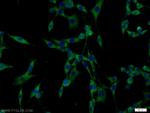 PAK1 Antibody in Immunocytochemistry (ICC/IF)