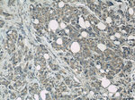 PAK1 Antibody in Immunohistochemistry (Paraffin) (IHC (P))