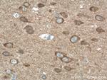 PAK1 Antibody in Immunohistochemistry (Paraffin) (IHC (P))