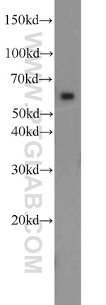 PAK1 Antibody in Western Blot (WB)