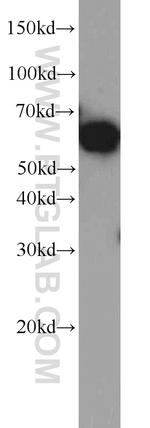 PAK1 Antibody in Western Blot (WB)