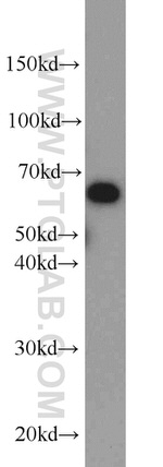 PAK1 Antibody in Western Blot (WB)