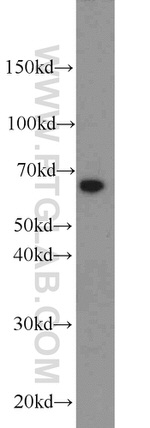 PAK1 Antibody in Western Blot (WB)
