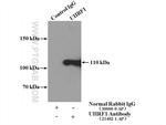 UHRF1 Antibody in Immunoprecipitation (IP)