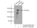 MYH10 Antibody in Immunoprecipitation (IP)