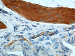 SMMHC Antibody in Immunohistochemistry (Paraffin) (IHC (P))