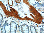 SMMHC Antibody in Immunohistochemistry (Paraffin) (IHC (P))