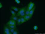 APRT Antibody in Immunocytochemistry (ICC/IF)