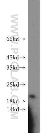 APRT Antibody in Western Blot (WB)