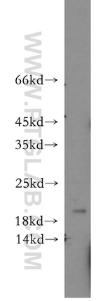 APRT Antibody in Western Blot (WB)