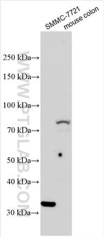 TGM3 Antibody in Western Blot (WB)