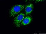 HIGD2A Antibody in Immunocytochemistry (ICC/IF)