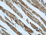 INPP5J Antibody in Immunohistochemistry (Paraffin) (IHC (P))