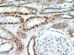 INPP5J Antibody in Immunohistochemistry (Paraffin) (IHC (P))