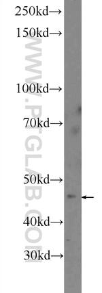 ASTL Antibody in Western Blot (WB)