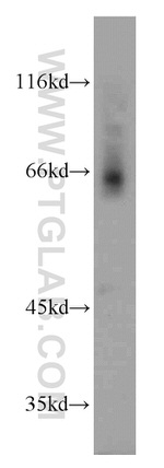 SLC24A6 Antibody in Western Blot (WB)
