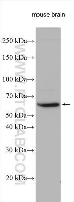 SLC24A6 Antibody in Western Blot (WB)
