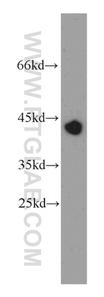 RNF150 Antibody in Western Blot (WB)