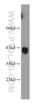 RNF150 Antibody in Western Blot (WB)
