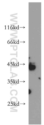 RNF150 Antibody in Western Blot (WB)