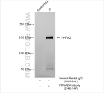 Liprin alpha 2 Antibody in Immunoprecipitation (IP)
