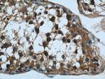 Rubicon Antibody in Immunohistochemistry (Paraffin) (IHC (P))
