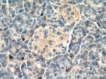 DDRGK1 Antibody in Immunohistochemistry (Paraffin) (IHC (P))
