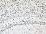DDRGK1 Antibody in Immunohistochemistry (Paraffin) (IHC (P))