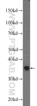 DDRGK1 Antibody in Western Blot (WB)