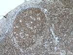 PVRIG Antibody in Immunohistochemistry (Paraffin) (IHC (P))