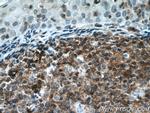 PVRIG Antibody in Immunohistochemistry (Paraffin) (IHC (P))