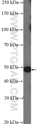ASB6 Antibody in Western Blot (WB)