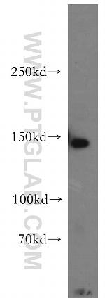 FAM62A Antibody in Western Blot (WB)