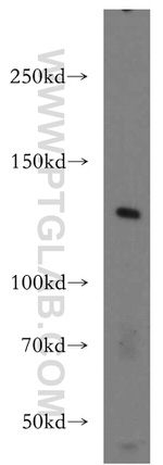 FAM62A Antibody in Western Blot (WB)