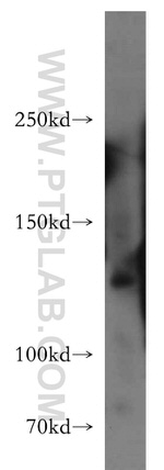FAM62A Antibody in Western Blot (WB)
