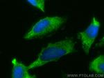 BAT2L Antibody in Immunocytochemistry (ICC/IF)