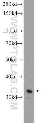C21orf59 Antibody in Western Blot (WB)
