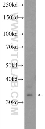 C21orf59 Antibody in Western Blot (WB)
