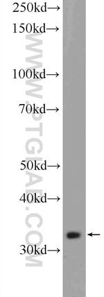C21orf59 Antibody in Western Blot (WB)