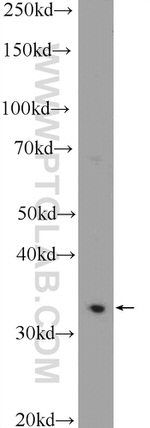 C21orf59 Antibody in Western Blot (WB)